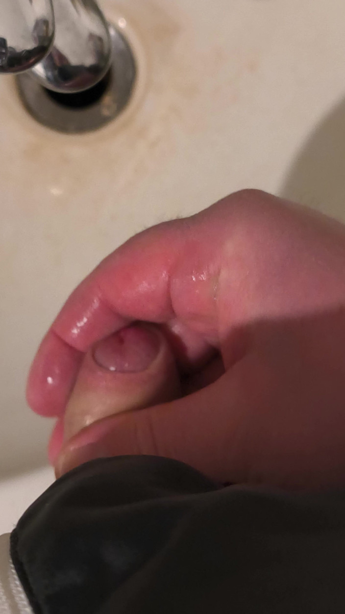 Uglydick: Потворний Вікс у коморі