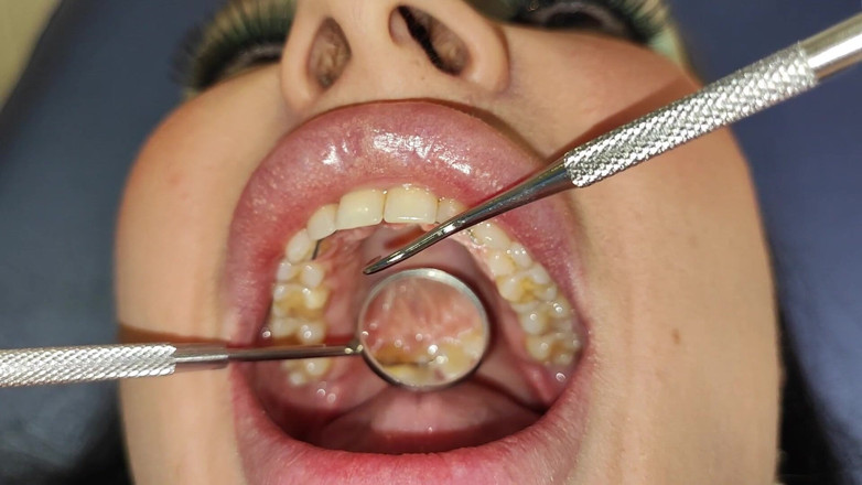 Princess18_: Complete Teeth Exam by the Dentist, Installation of Jewelry