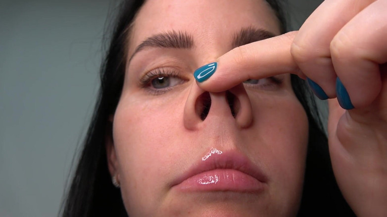Anna Sky: Anna Sneezes and Blows Her Nose with a Pig Nose