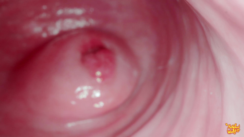 MollyRedWolf: Salut mon demi-frère ! Jouons au gynécologue ? Gynécologie, endoscopie - Mollyredwolf