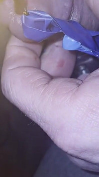 Candle Wax Peehole Inserare
