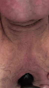 Anal Gape