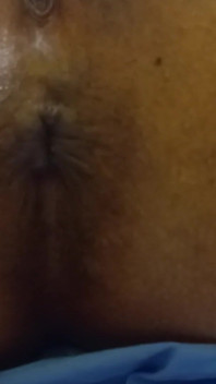 Showing Pussy and Asshole