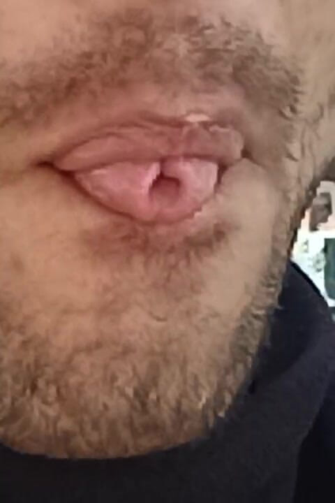 Thakursammy: Sexy mondcomplicatie