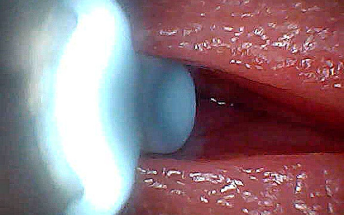Creme sperm: Ich Konnte Nicht Glauben, Was Im Penis Passiert, Während Sperma...